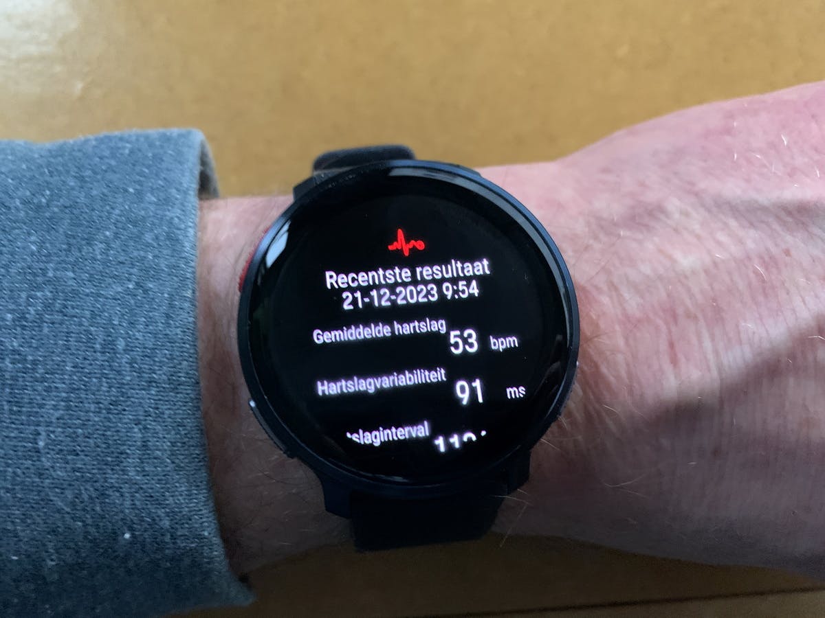 De Vantage v3 kan een niet-medische ECG maken.